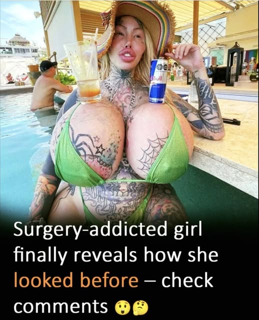 Woman who wants to become a ‘forest elf,’ gets Barbie nose and cat eyes in new extreme procedure