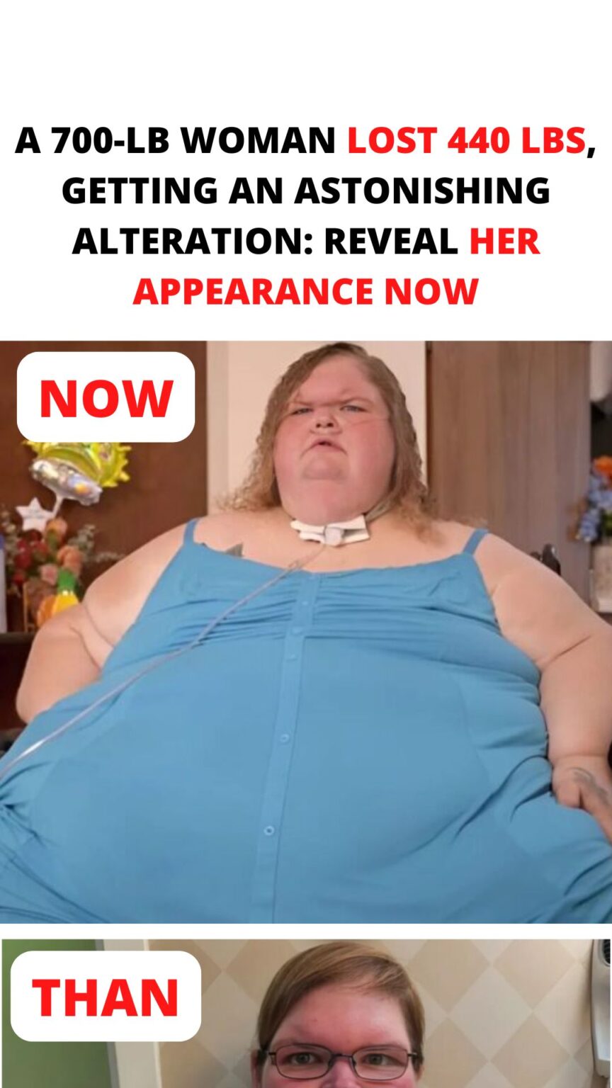  700-Lb Woman Lost 440 Lbs, Getting An Astonishing Alteration: Reveal Her Appearance Now