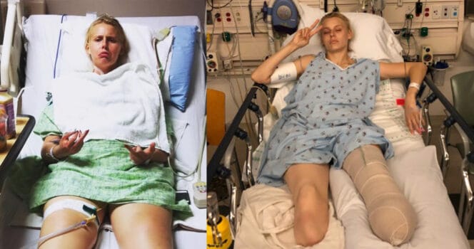 Her legs are amputated after using a common household product