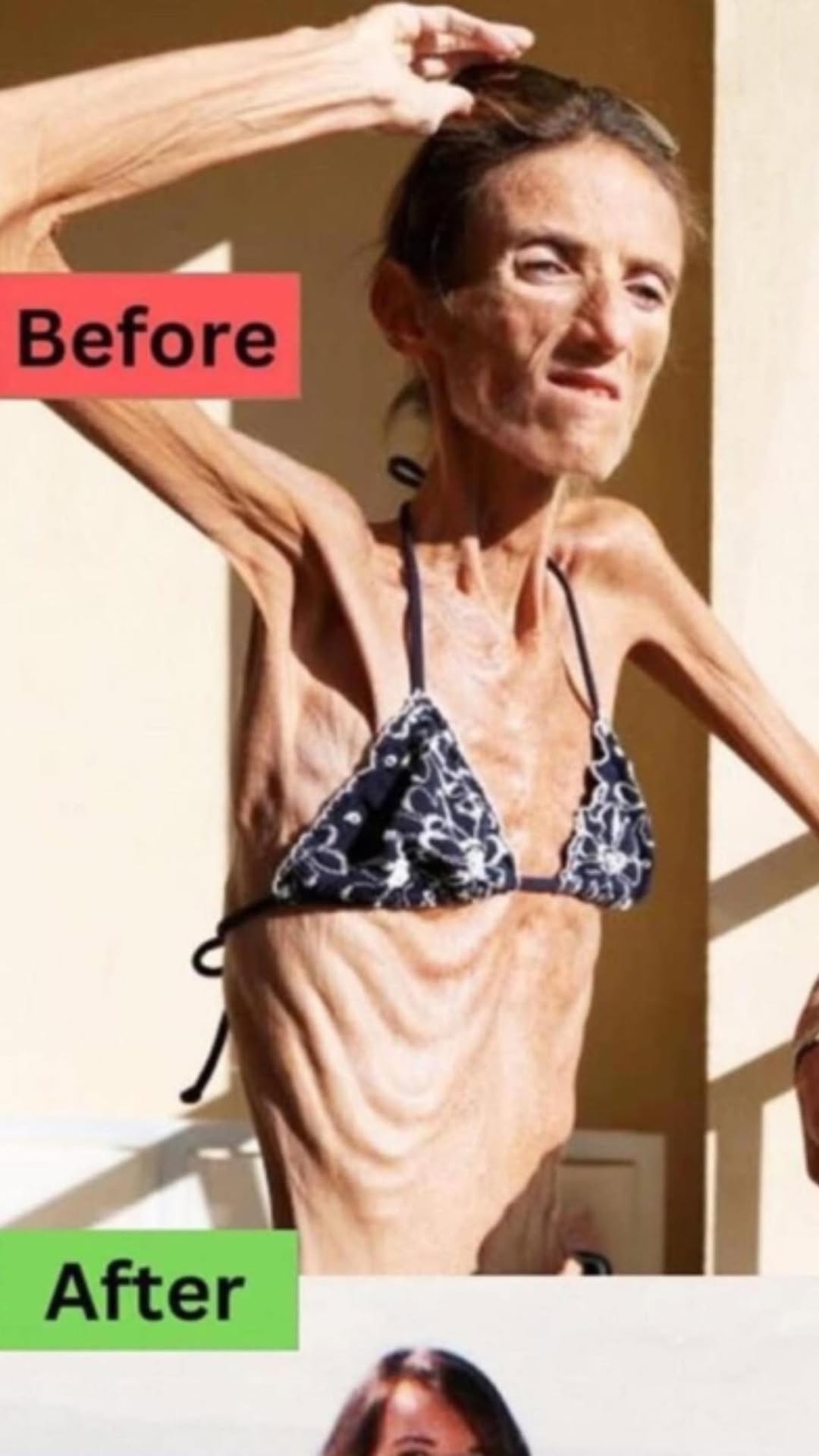 I get FAN MAIL’: World’s thinnest woman warns against anorexia as she reveals girls idolise her look