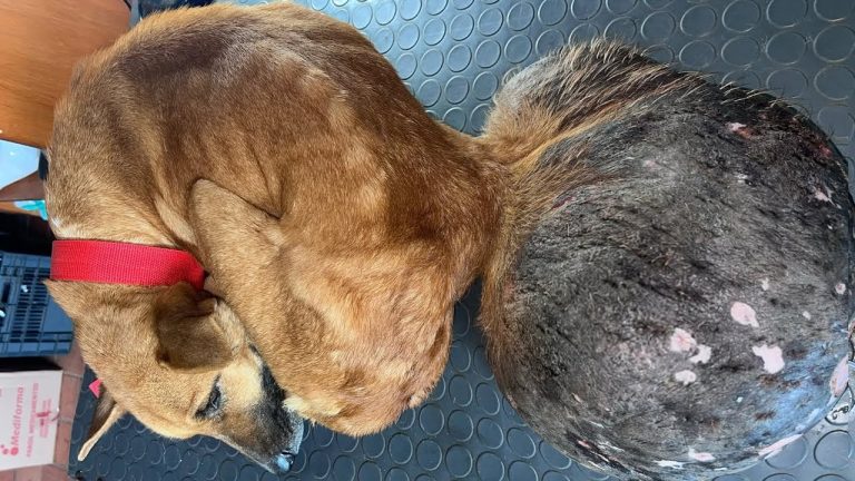 She Carried This Heavy Tumor All Her Life…Until One Lucky Day, Everything Turned Out Great For Her