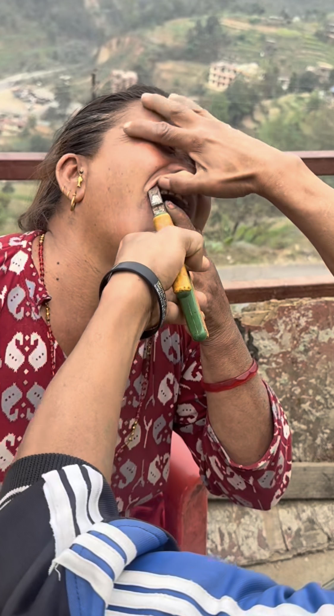 The Pain Behind the Smile