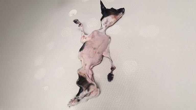 His completely deformed body made everyone bully him, but his recovery journey is amazing